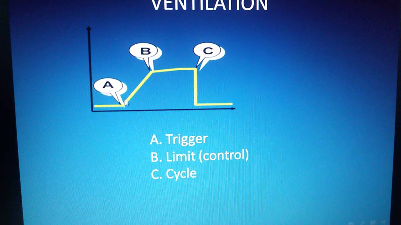 chapter 2 basics of neonatal ventilation. 1