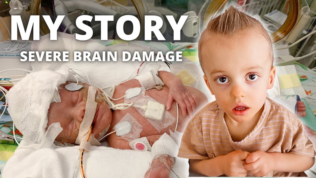 LIFE WITH GRADE 3 BRAIN DAMAGE | CEREBRAL PALSY TODDLER