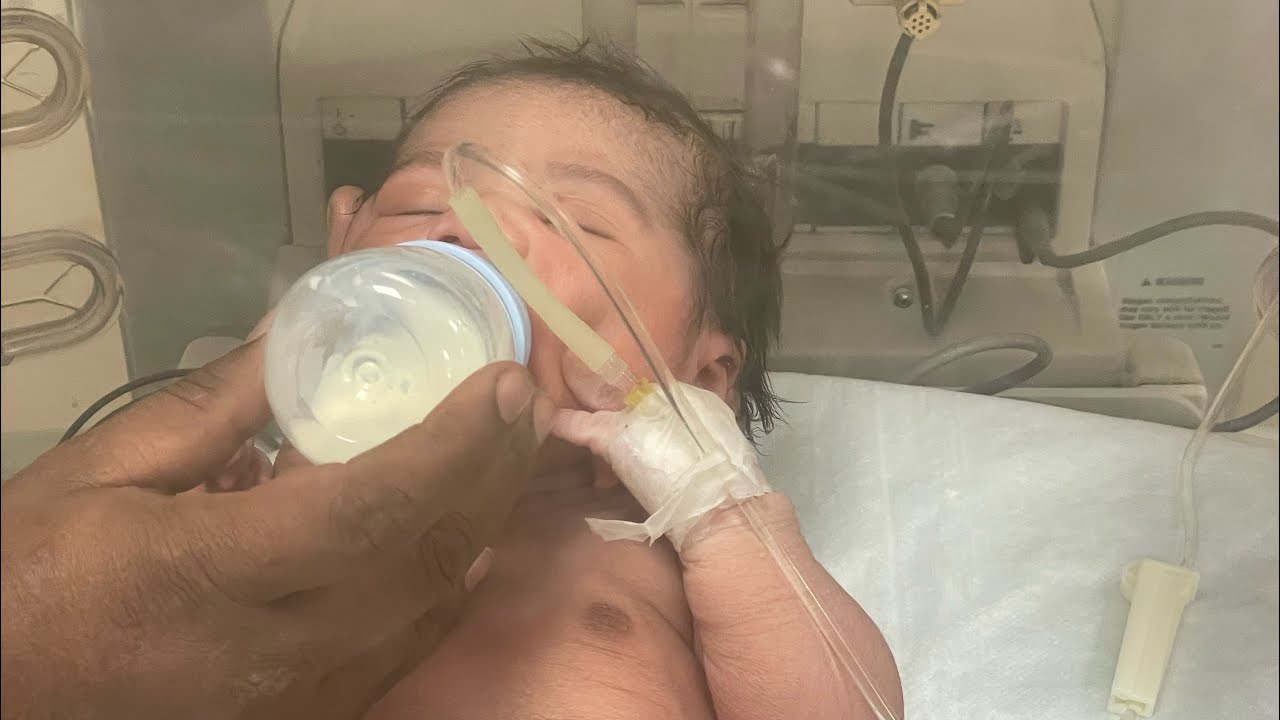 Feeding time of this cute little baby with compline of juindice❤️