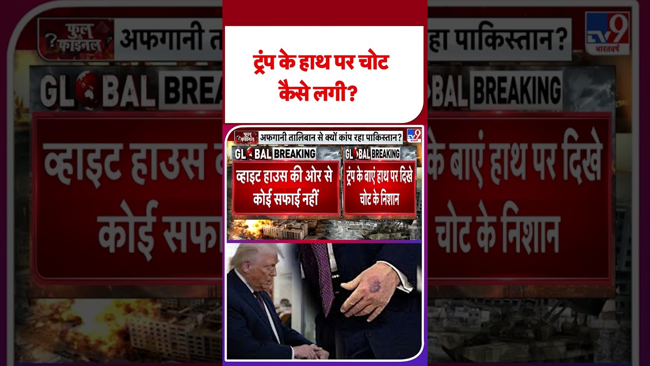Breaking News: ट्रंप के हाथ पर चोट कैसे लगी? | Donald Trump | 
