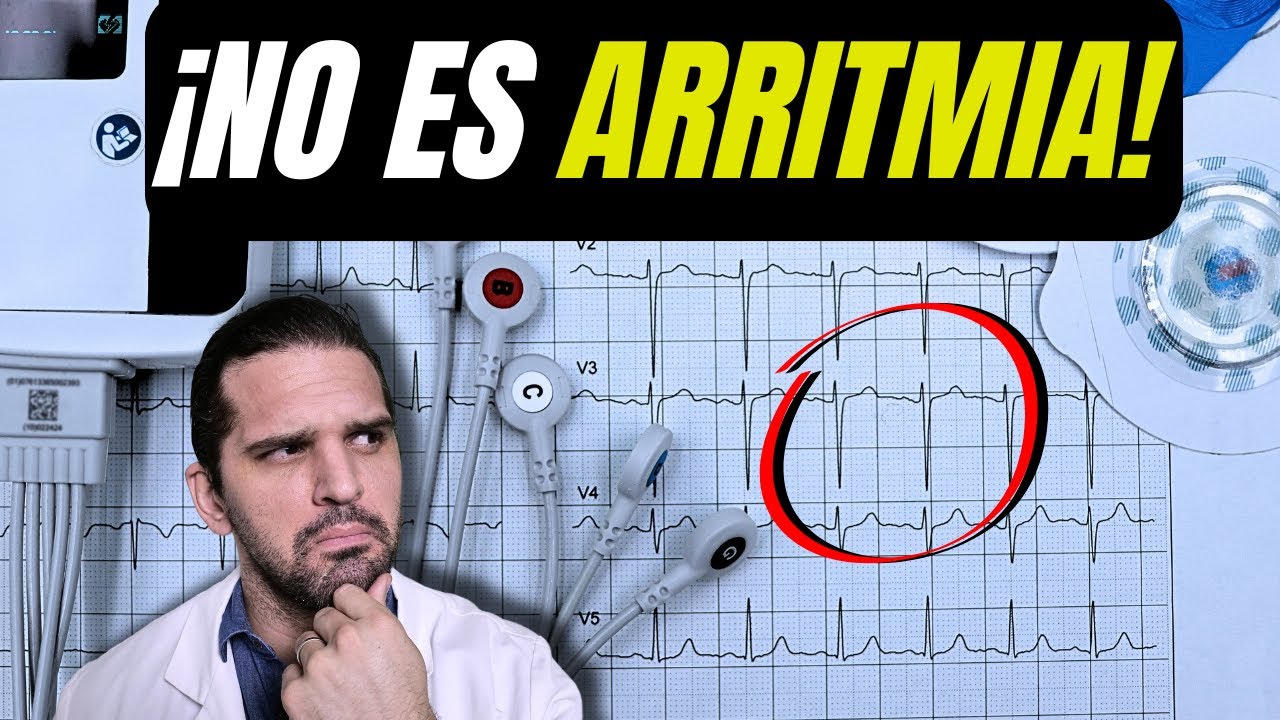 NO toda PALPITACIÓN es arritmia | Caso REAL con Holter 😲