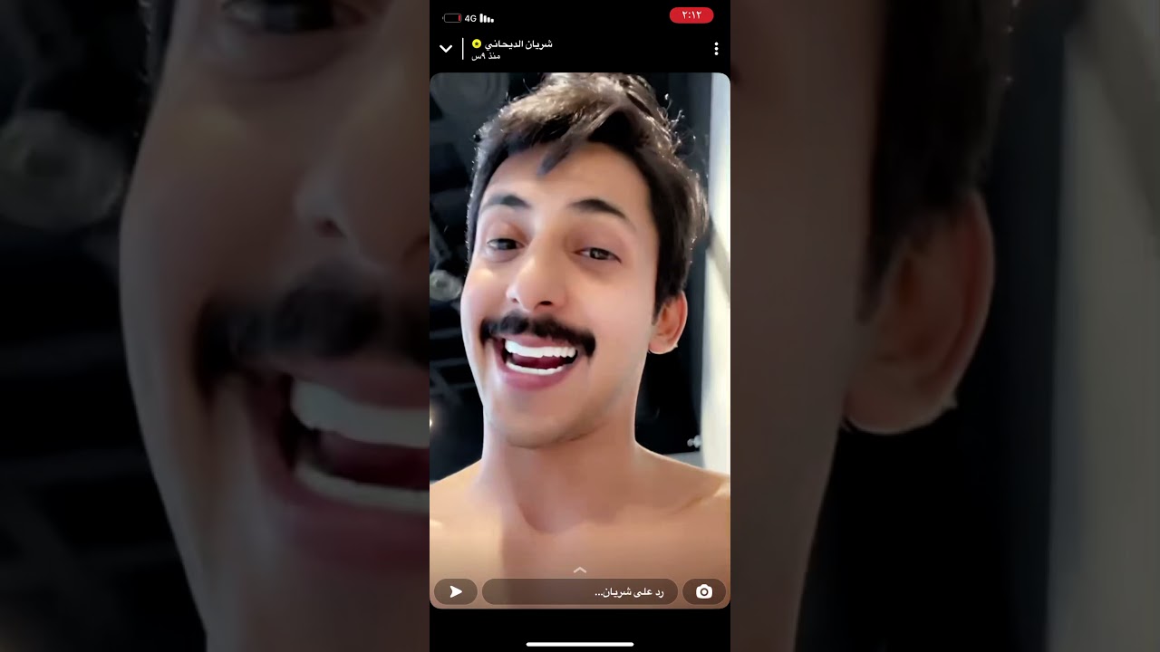 سنابات شريان الديحاني والزحزيح والشريك حاقد على اخوه🤣😂💔