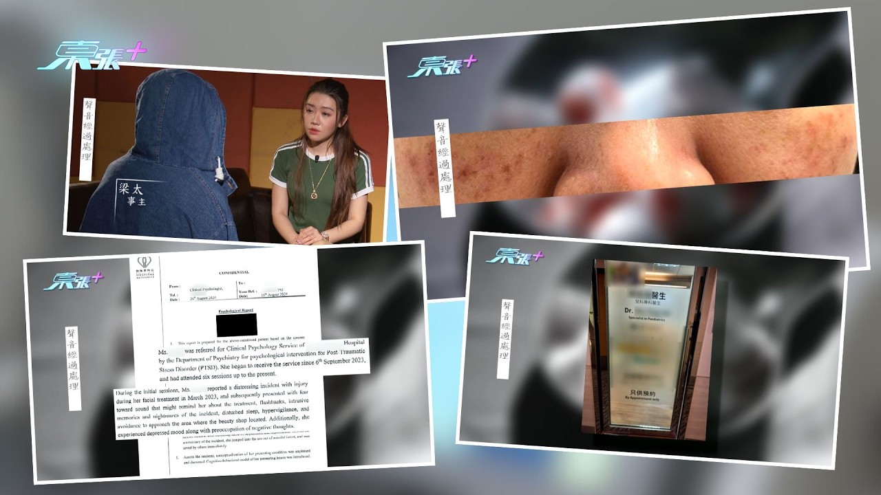 東張西望｜做激光療程做到留疤痕仲患PTSD　苦主慘報《東張》誓向美容院討損失（上集）｜美容療程｜激光療程｜留疤痕｜PTSD｜美容院｜Pico袪斑｜臉部紅腫｜廖倬竩