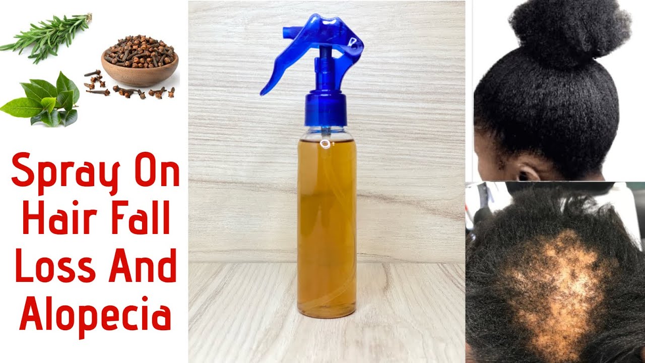 MIX CLOVES ROSEMARY & BAY LEAVES, Spray Under Your And Massage Everyday To Grow Back Your Baldness