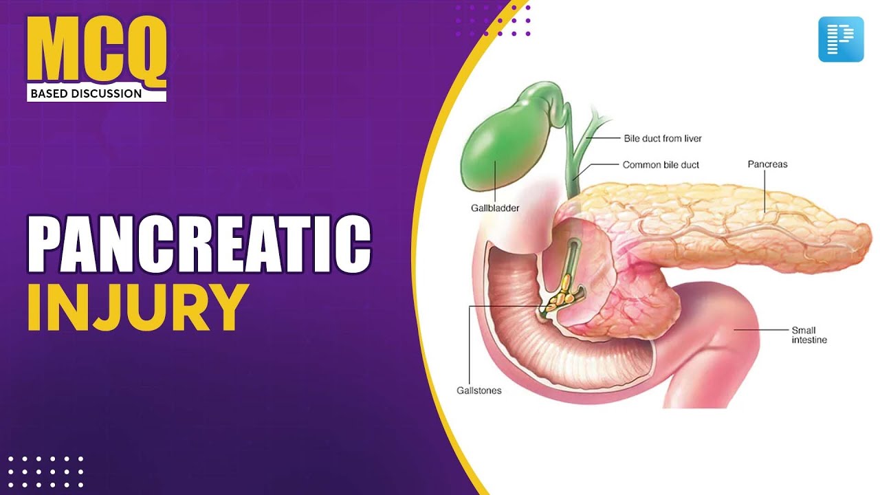 Pancreatic Injury [General Surgery] - NEET SS MCQ Discussion