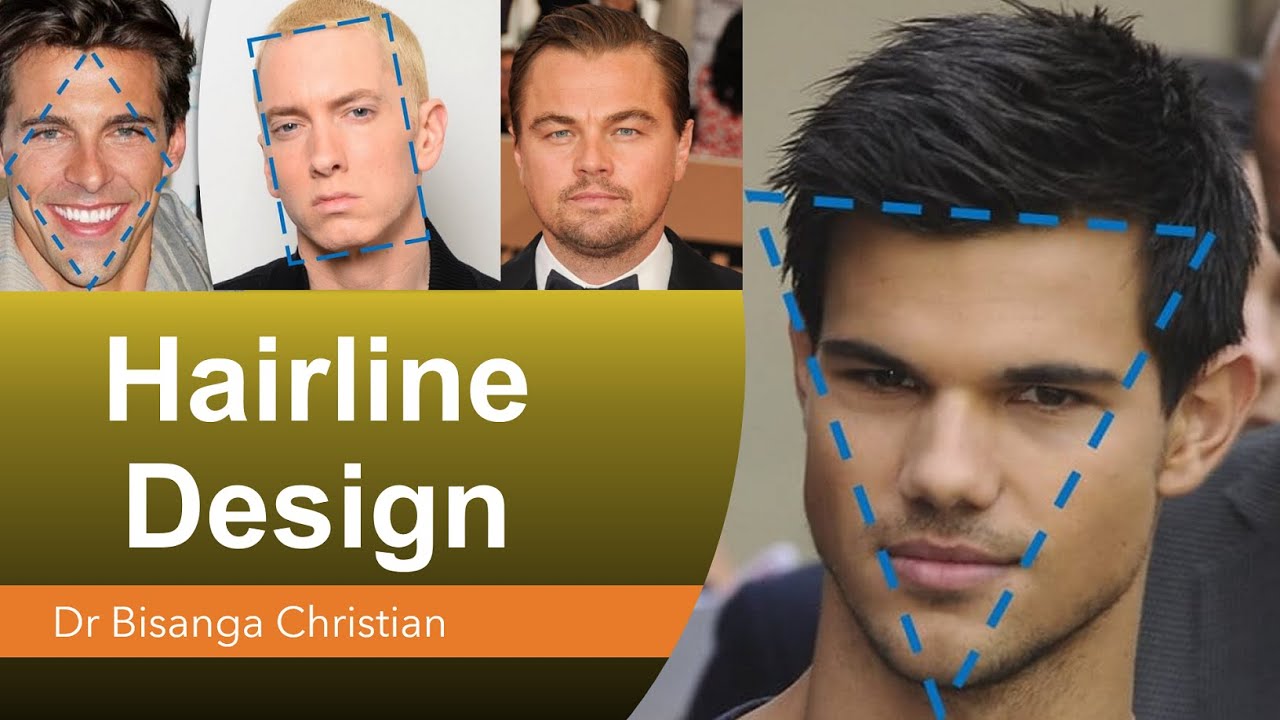 FUE Hairline Design: How To Get A 100% Natural Hair Transplanted HairLine!