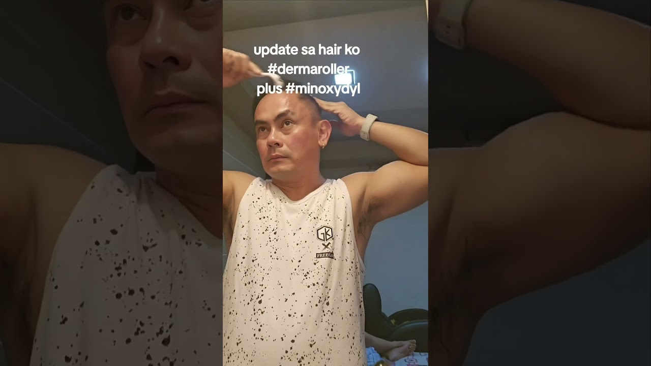 Numinipis na buhok? Kaya ‘yan! 👊