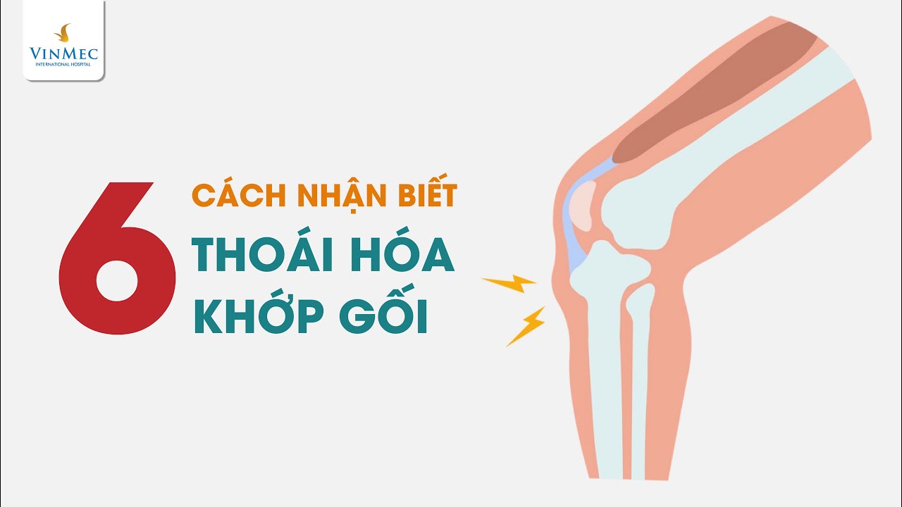 6 triệu chứng thoái hóa khớp gối cần chú ý