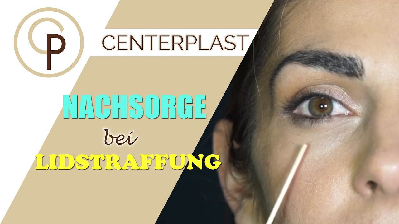 Lidstraffung-Nachsorge: 5 Tipps f&uuml;r schnelle Heilung & perfektes Ergebnis!