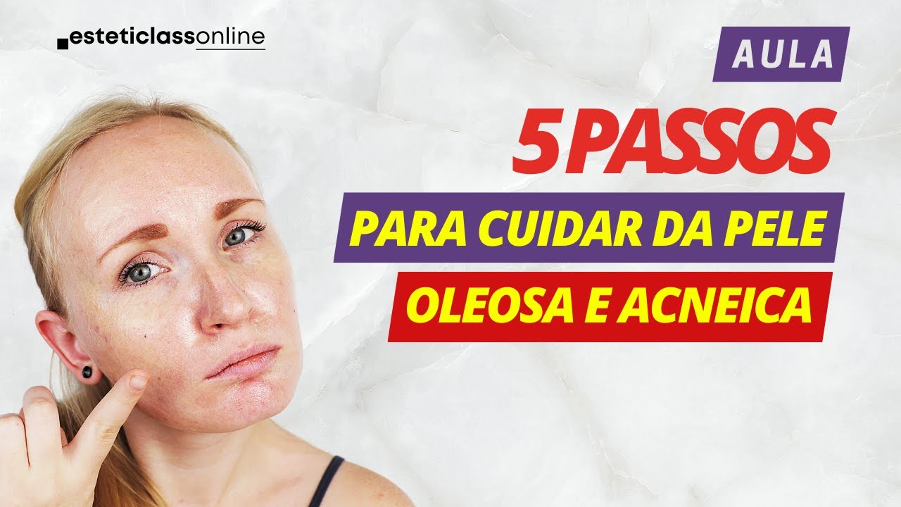 SKINCARE - 5 PASSOS PARA CUIDAR DA PELE OLEOSA E ACNEICA