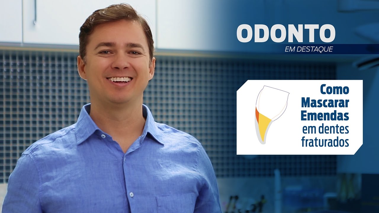 Como mascarar emendas em dentes fraturados | Leonardo Muniz