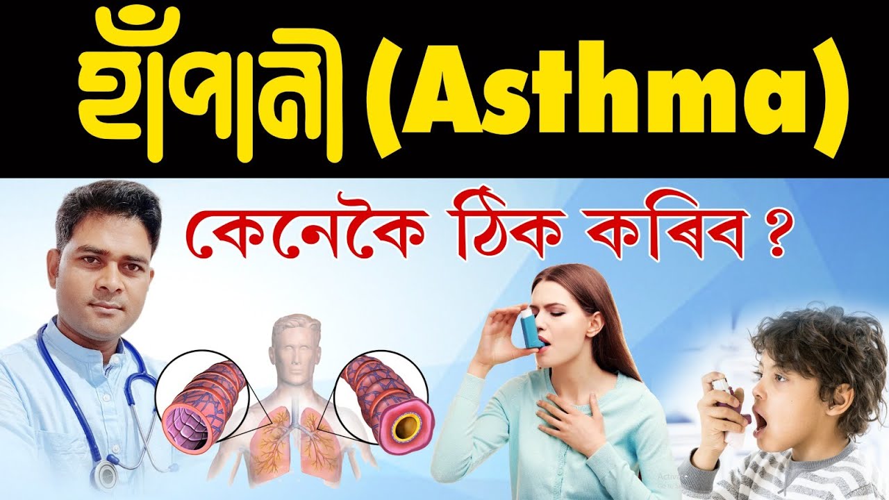 এজমা বা হাঁপানি ৰোগৰ পৰা মুক্ত হবলৈ কি কি মেডিচিন খাব ? Dr Haris Well future