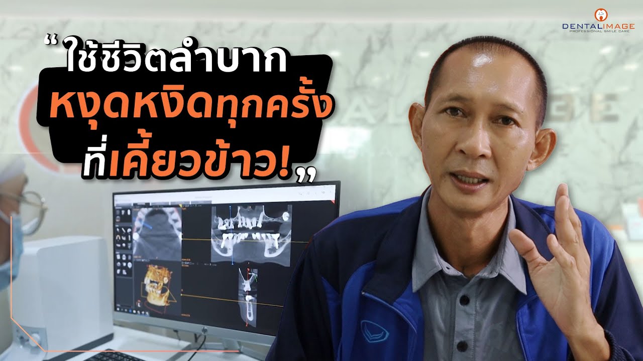 ใช้ชีวิตลำบาก...หงุดหงิดทุกครั้งที่เคี้ยวข้าว! | รีวิวคนไข้รากเทียม เคสคุณหมอธนกฤต Dentalimage