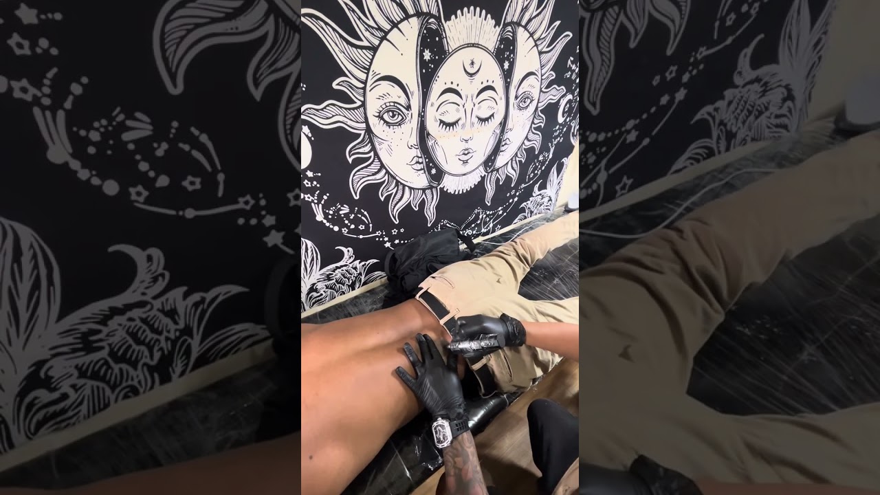 nakakapangit talaga ng mukha ang removal | #TattooRemoval #1SessionOnlyTanggalAgad