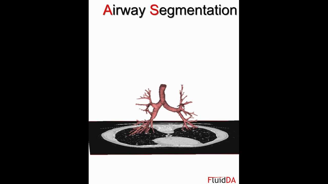 Functional imaging in the respiratory field
