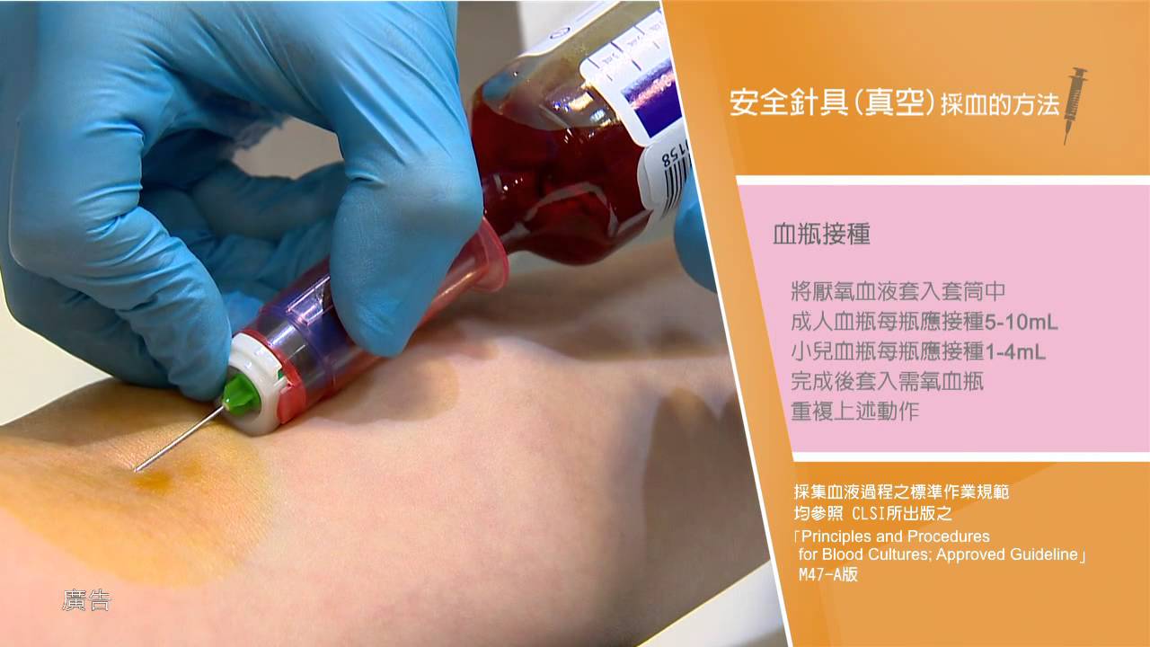 正確採集檢驗標本(疾管署2014)