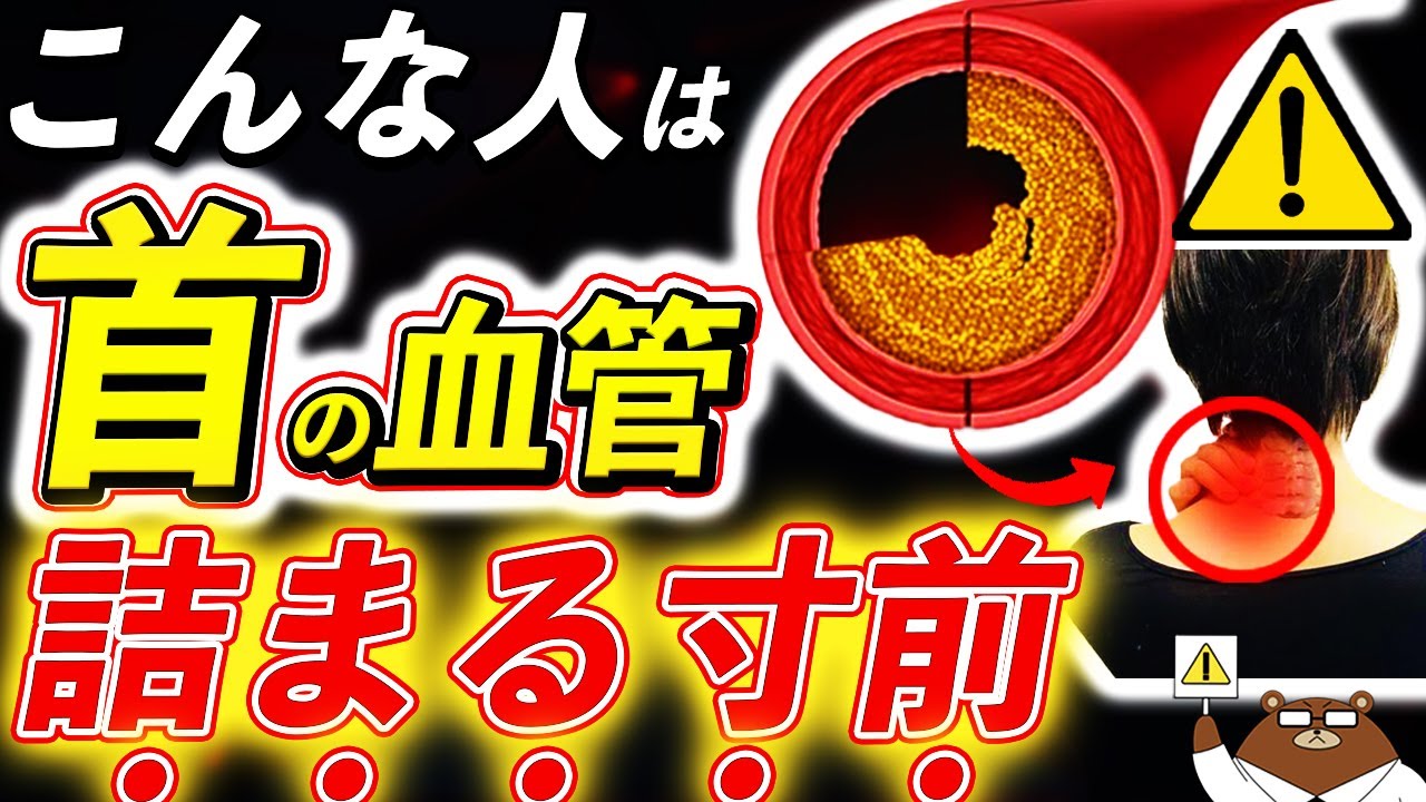 放置厳禁！知らないと後悔する「首」の血管が詰まる直前の危険サイン。「頸動脈狭窄症」の正体とは。「不安定プラーク」とは何？首のプラークは消せる？予防法は？医師が完全解説します。