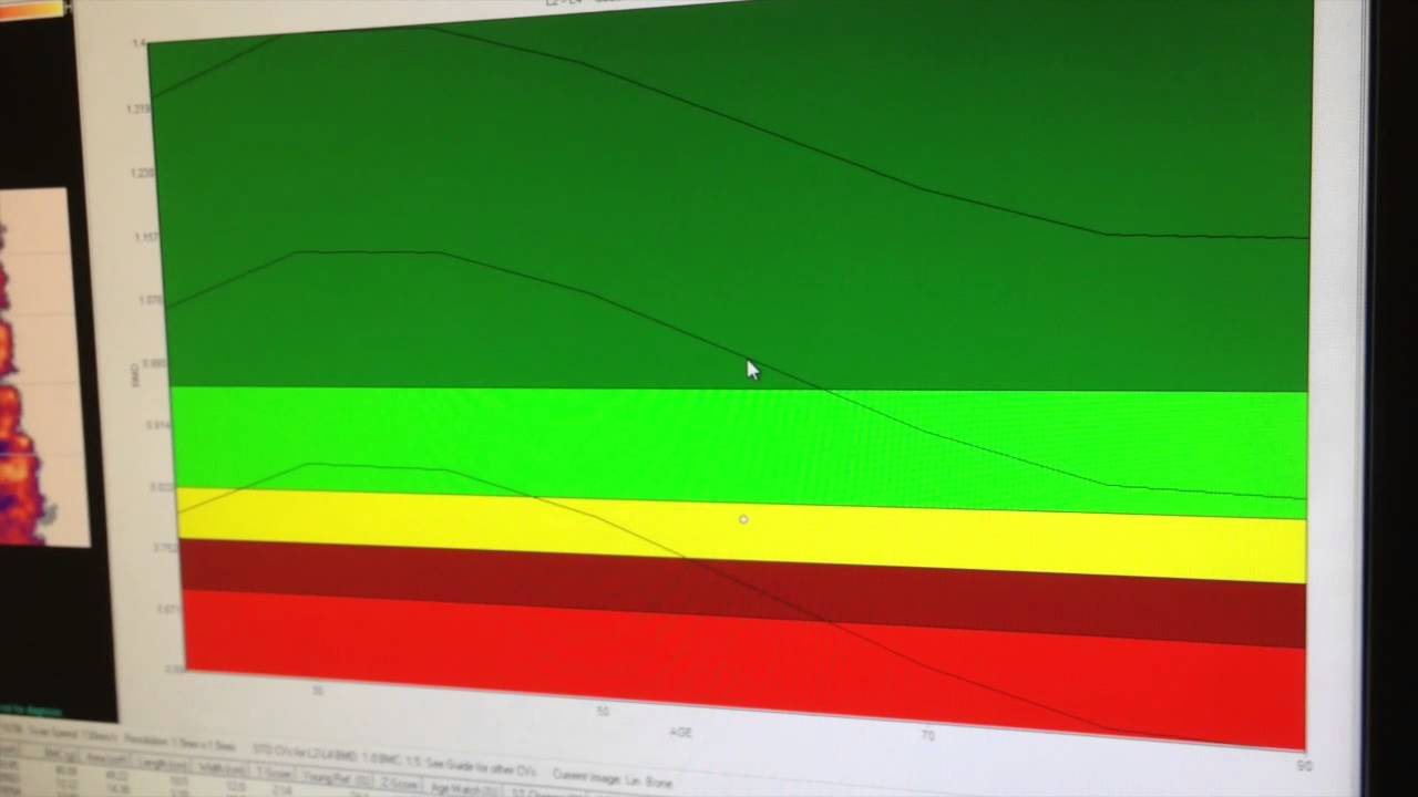 how to read a DXA scan