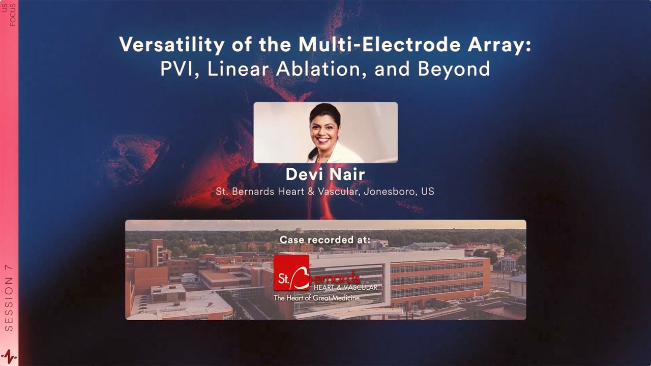 Versatility of the Multi-Electrode Array: PVI, Linear Ablation, and Beyond