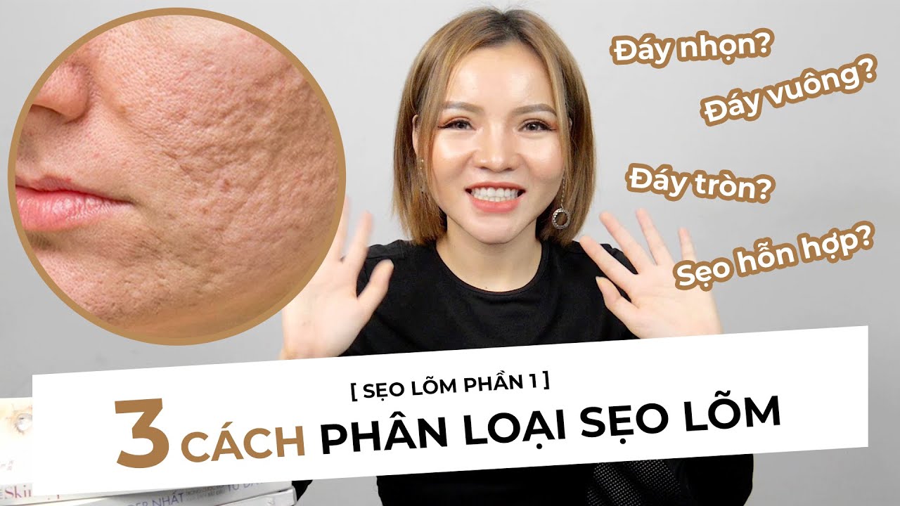 TRỊ SẸO RỖ [P1] - 3 CÁCH PHÂN LOẠI SẸO LÕM CHUYÊN SÂU