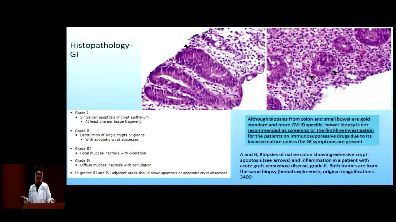 Graft-Versus-Host Disease After Solid Organ Transplantation
