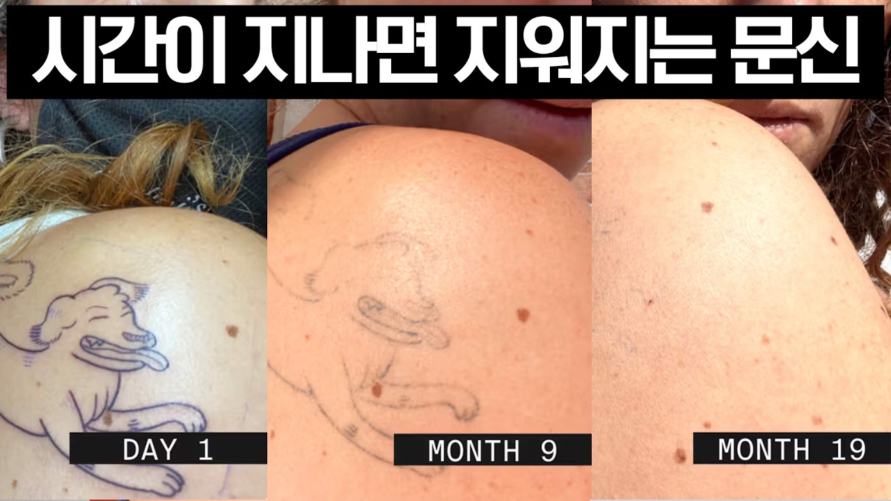해외에서 판매되고 있는 지워지는 문신 잉크;;