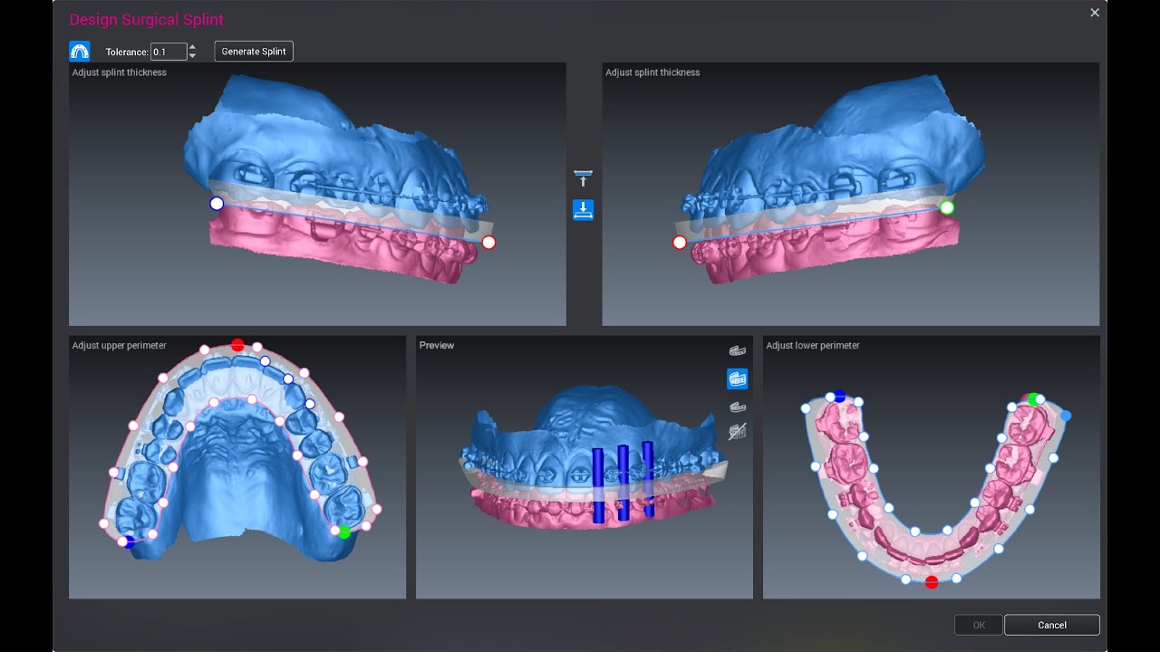 Romexis® CMF Surgery Online Training