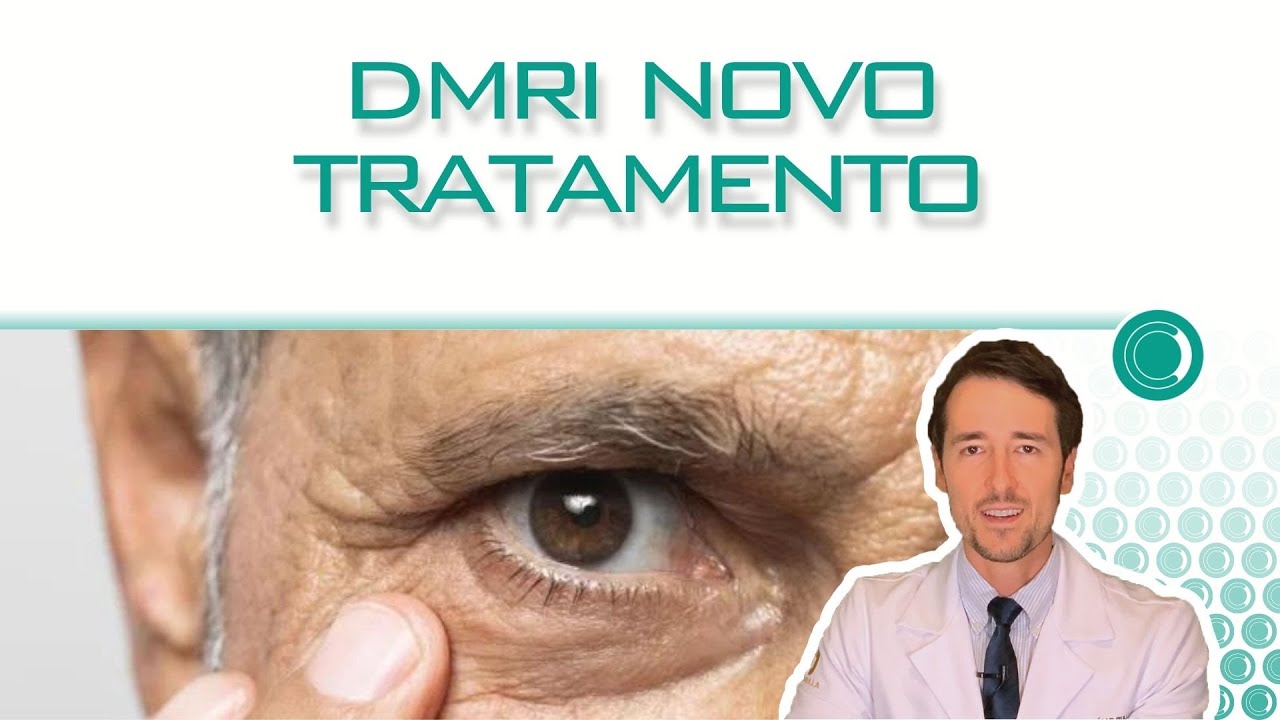 Novo tratamento para a degeneração macular - Vabysmo