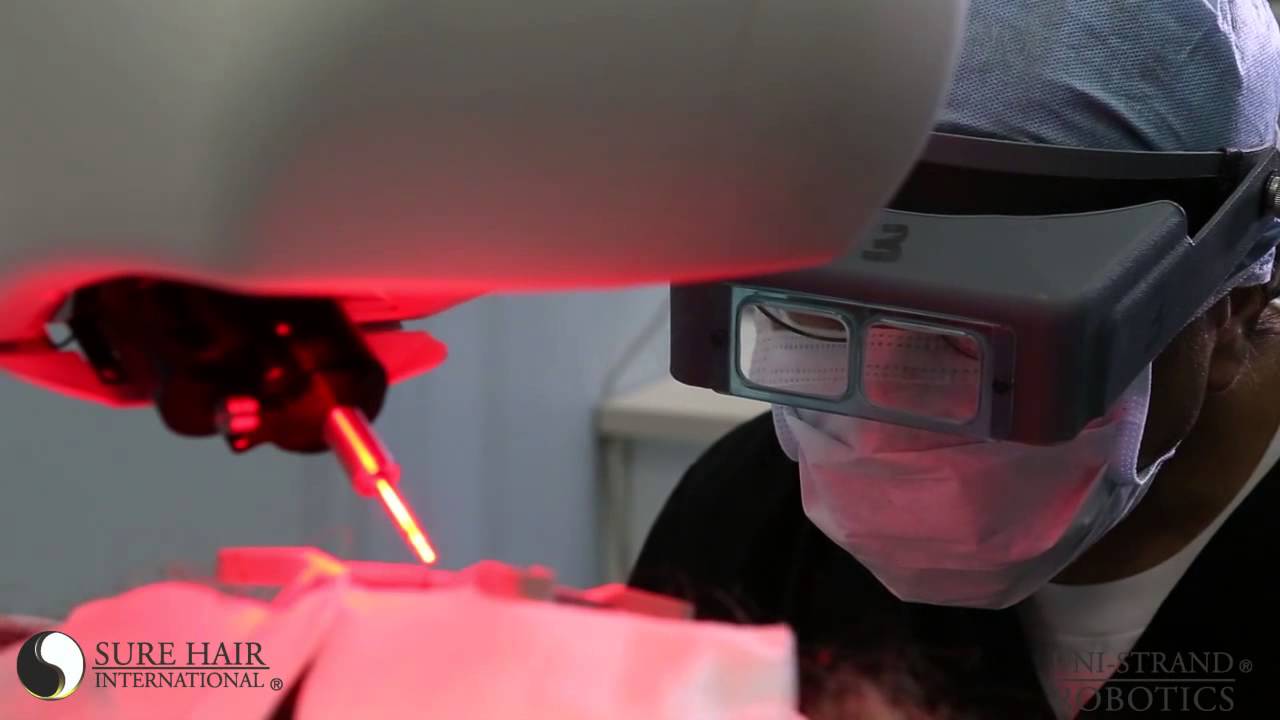 ARTAS Hair Transplant Doctor - Toronto, Ottawa, Hamilton, Guelph, Kitchener, Waterloo
