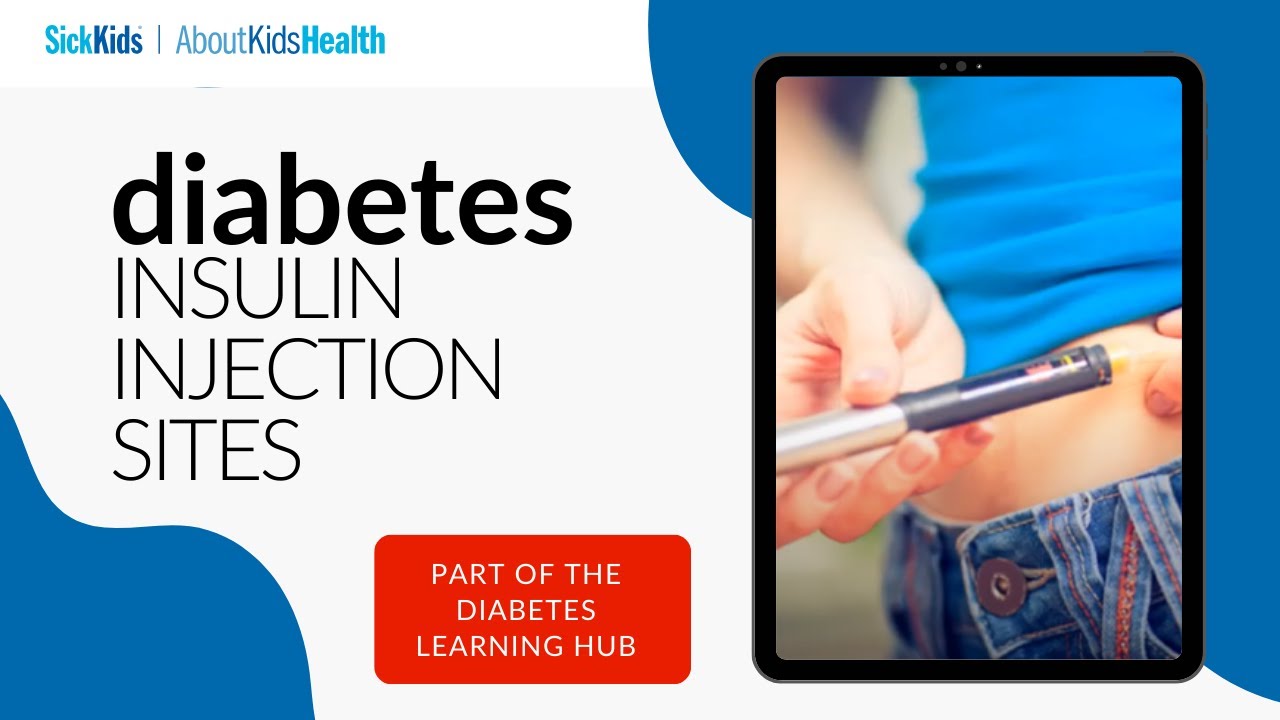 How and where to best inject your insulin | AboutKidsHealth at The Hospital for Sick Children