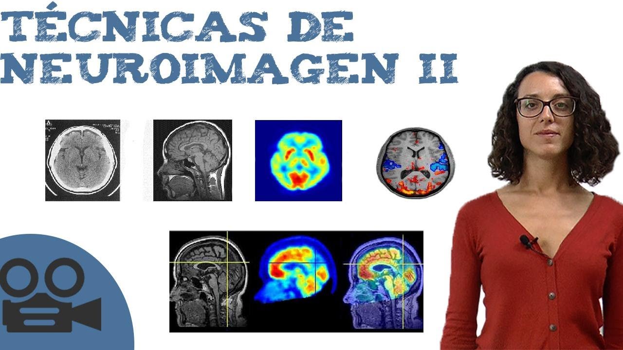 Técnicas de neuroimagen II