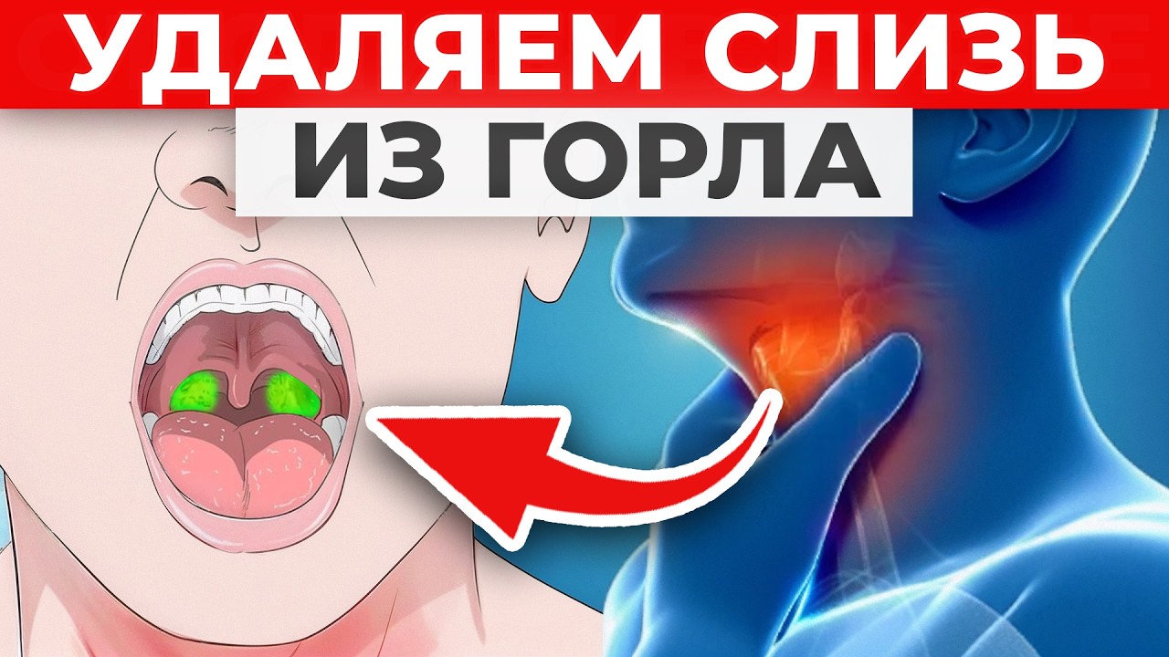Вот как быстро избавиться от слизи в горле в домашних условиях!