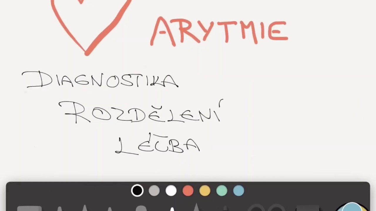 ARYTMIE