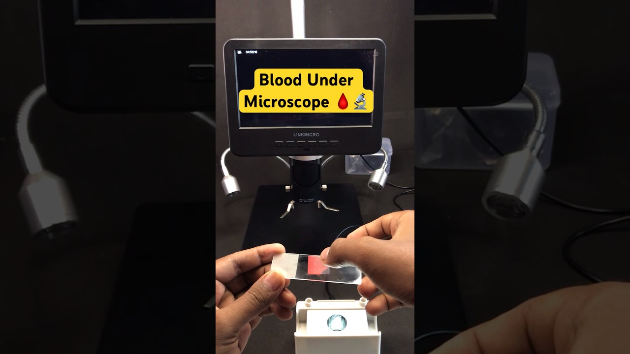 Blood Under Microscope | Preparing a Blood Sample slide | Slide from Blood Sample #linkmicro