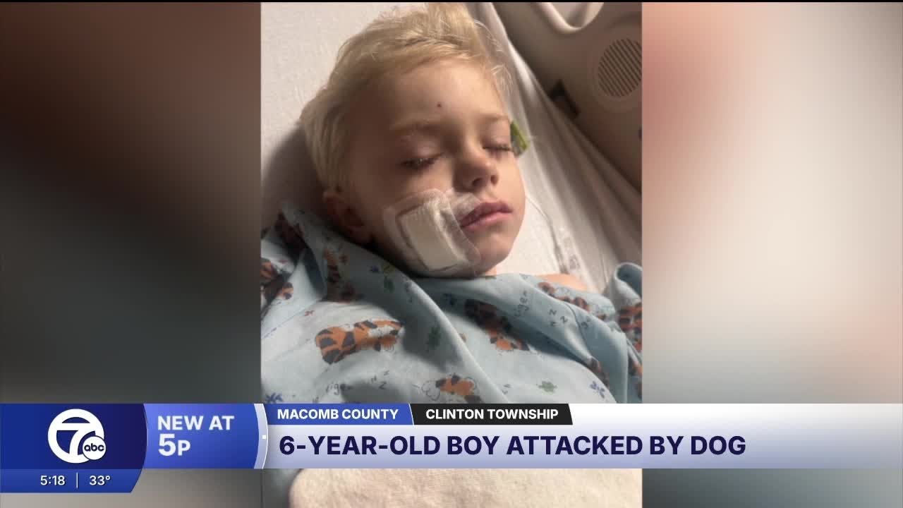 6-year-old Clinton Township boy hospitalized after neighbor's pit bull bites him