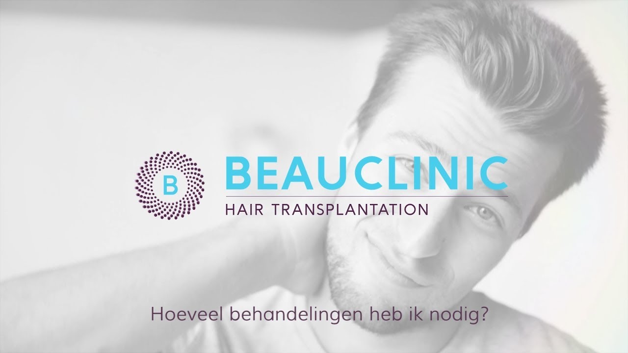 Hoeveel haartransplantatie behandelingen heb ik nodig?