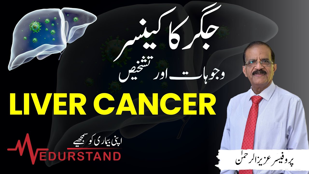 Urdu: جگر کا کینسر | Liver Cancer Part-1 | Cause and Diagnosis | Medurstand by Prof Aziz ur Rehman