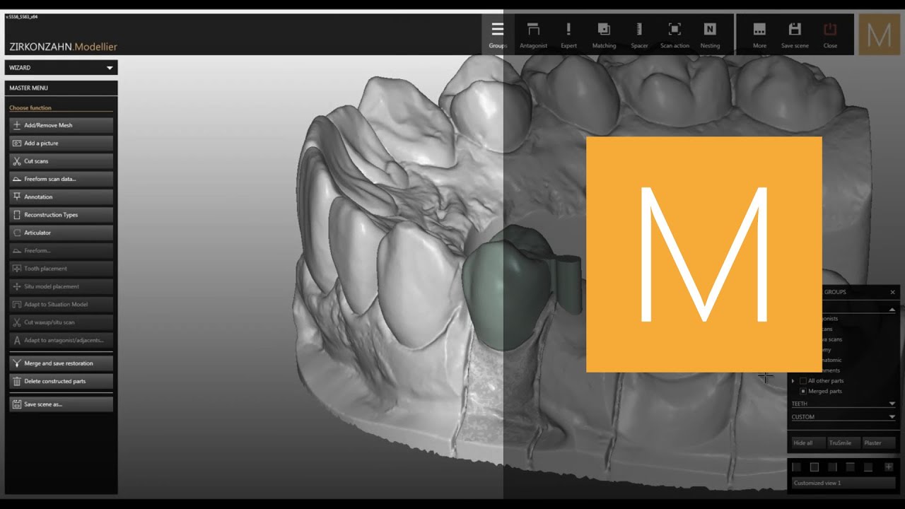 Attachments software module of Zirkonzahn.Modellier | Zirkonzahn.Software