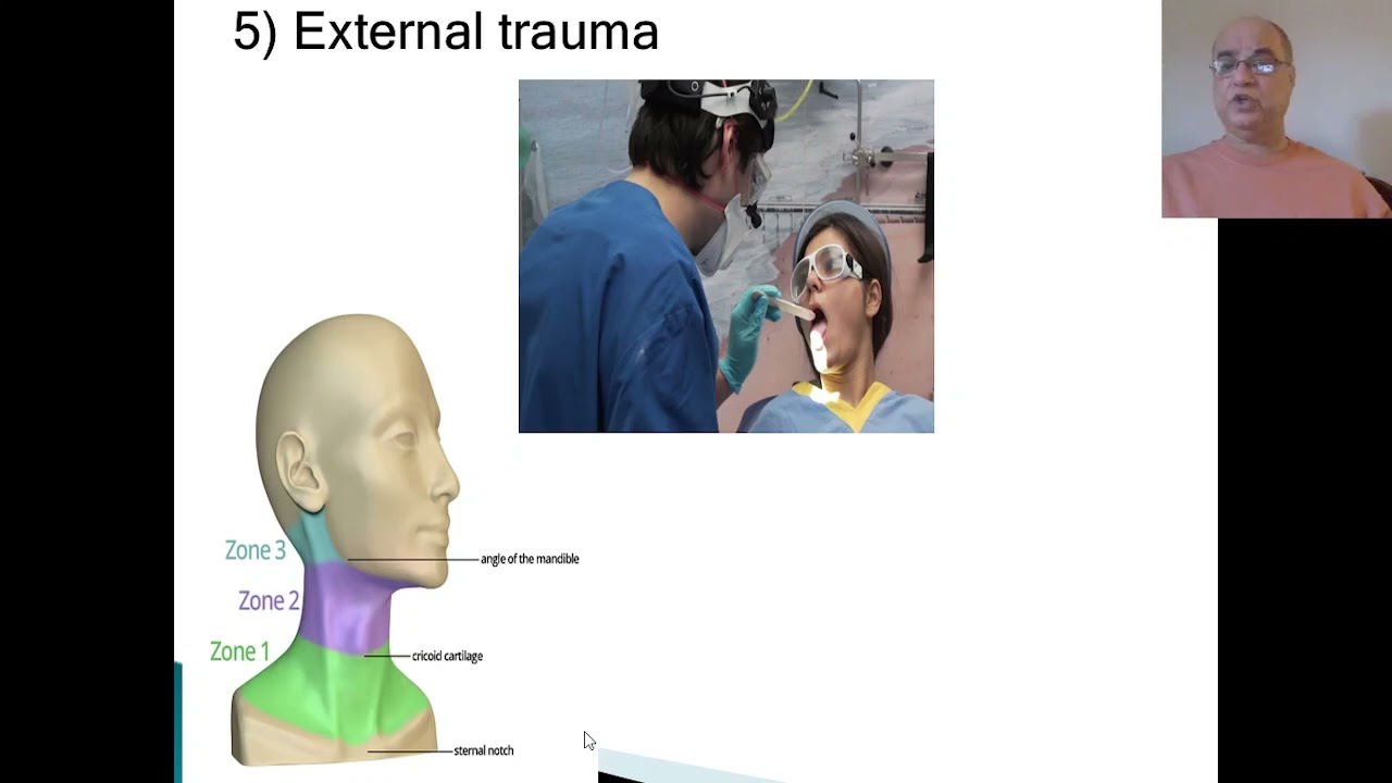 Parapharyngeal abscess, Lateral pharyngeal space abscess, Head n neck space infecitons