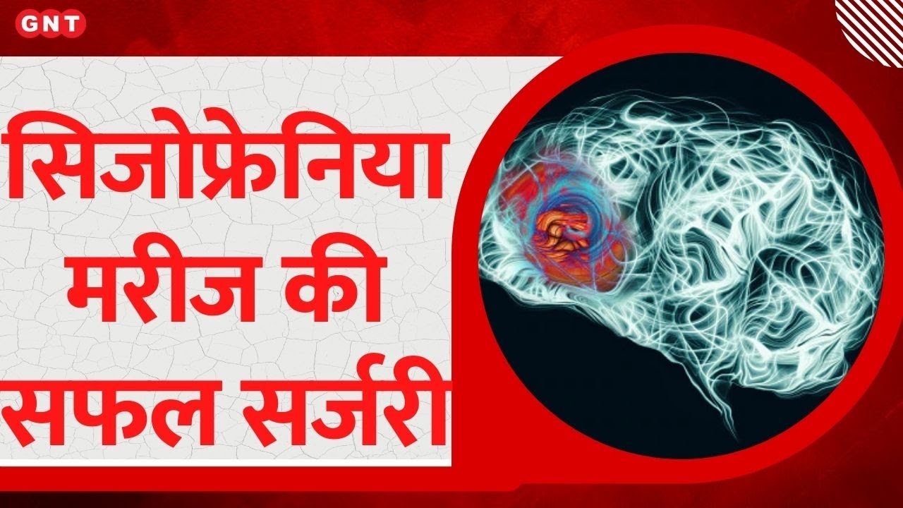 Good News: भारत में पहली बार Schizophrenia से पीड़ित मरीज की सफल सर्जरी, जानिए पूरी डिटेल