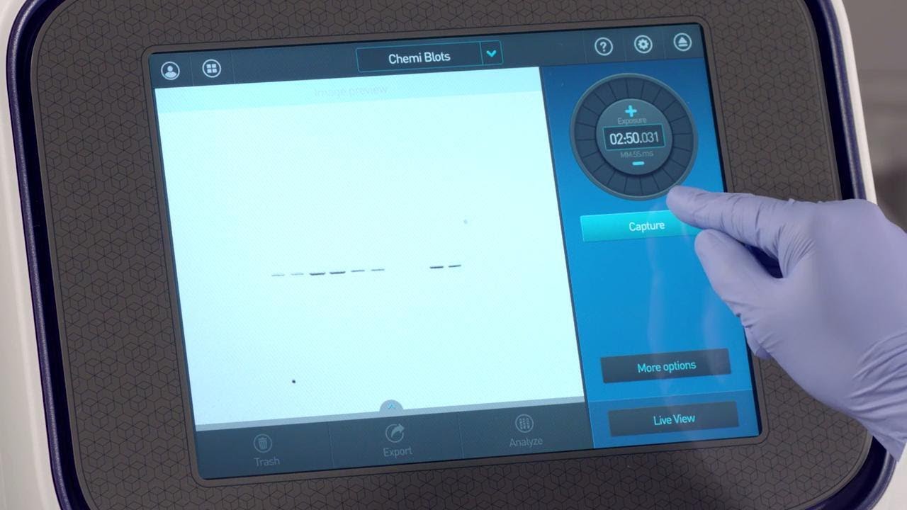 iBright Imaging System: Capture Fluorescent Western Blots