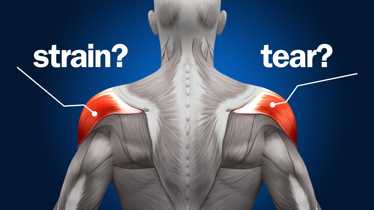 Top 3 Ways To Tell A Shoulder Strain Apart From A Rotator Cuff Tear