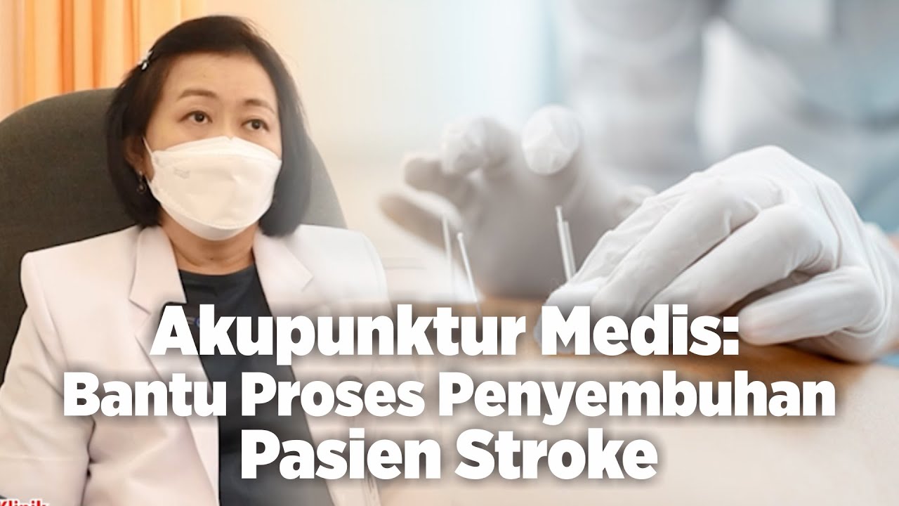 Akupunktur Medis: Bantu Proses Penyembuhan Pasien Stroke