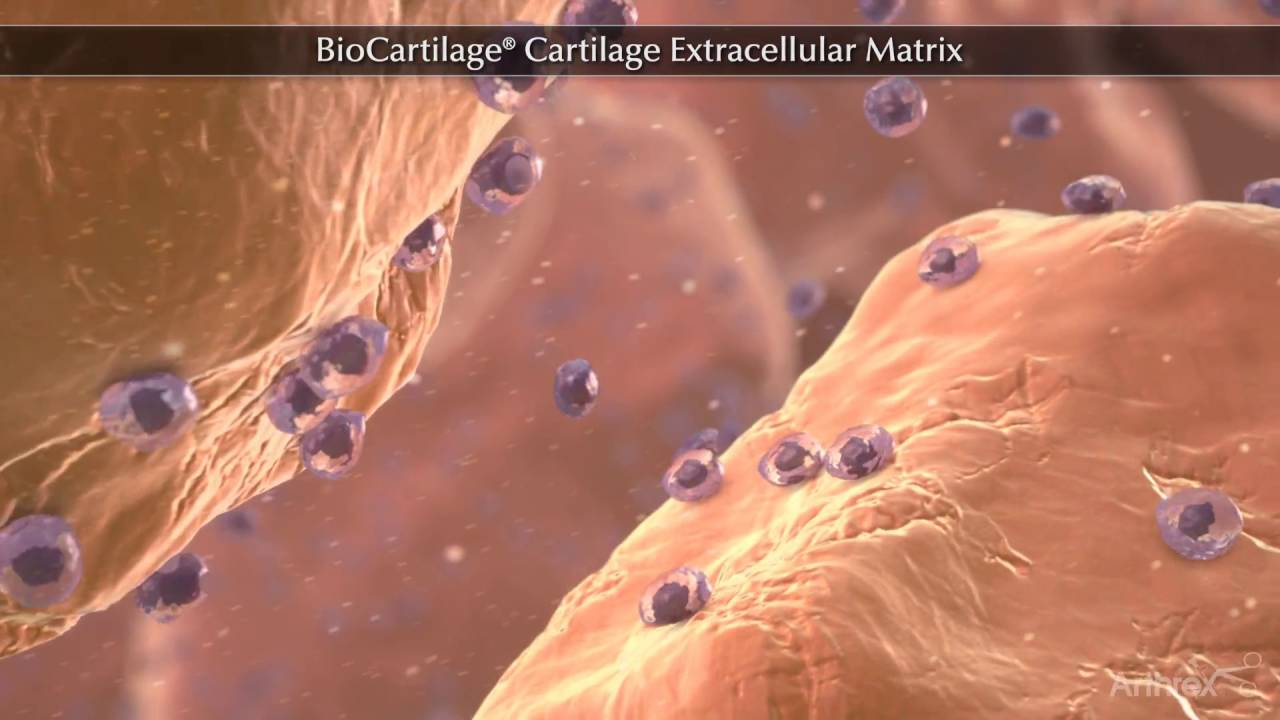 BioCartilage&reg; Cartilage Extracellular Matrix