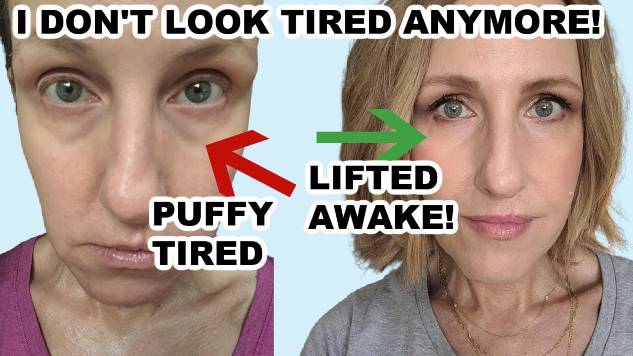 GET RID OF EYE BAGS AND PUFFINESS IN MINUTES!