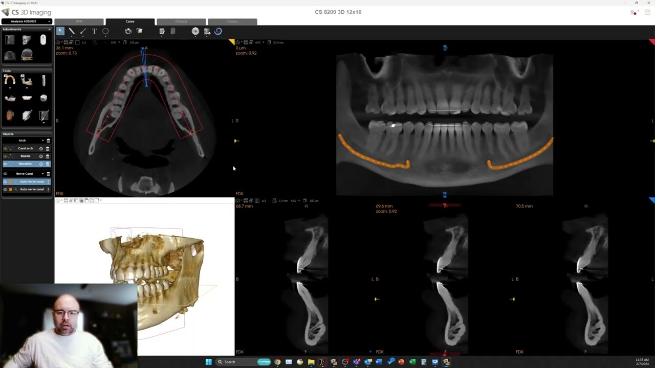 AI-powered tracing features