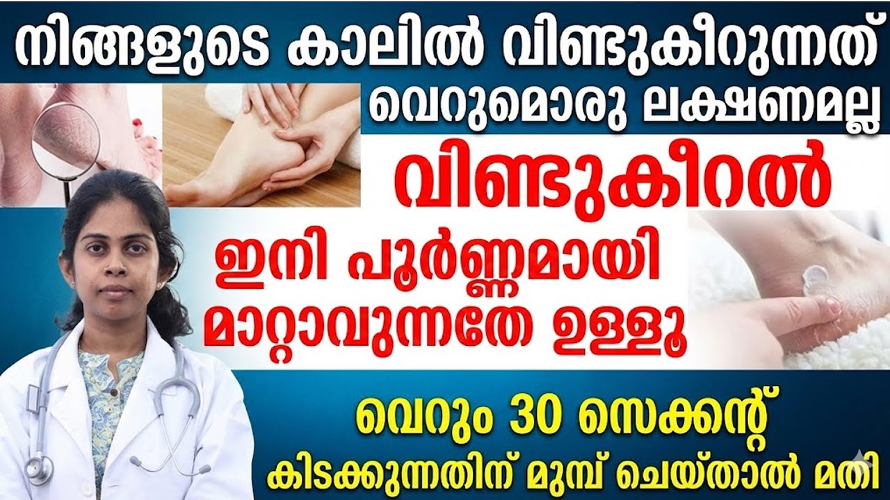 വിണ്ടുകീറൽ കാരണം ബുദ്ധിമുട്ടുന്നവരാണോ നിങ്ങൾ |രാത്രി കിടക്കുന്നതിന് മുൻപ് ഇങ്ങനെ ചെയ്‌താൽ