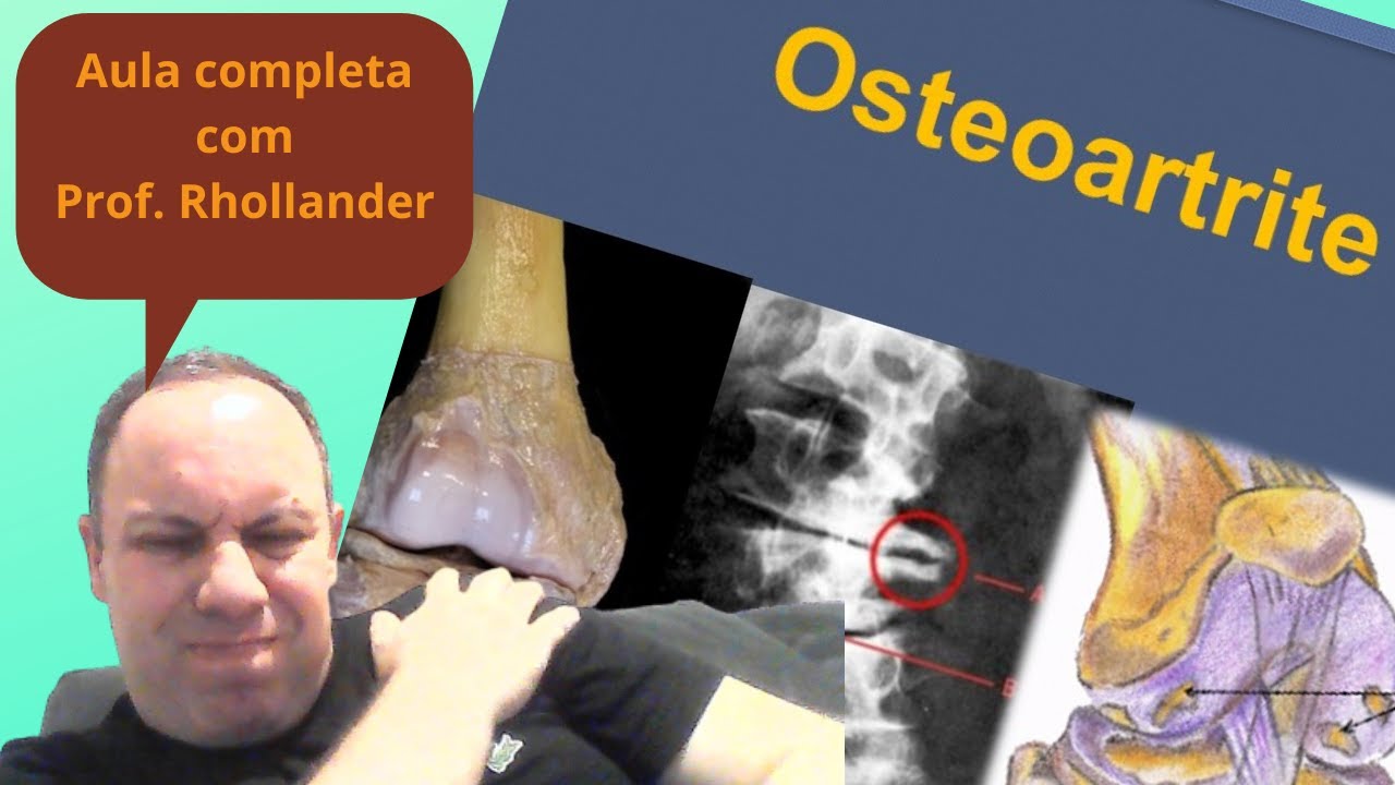 Osteoartrite aula completa
