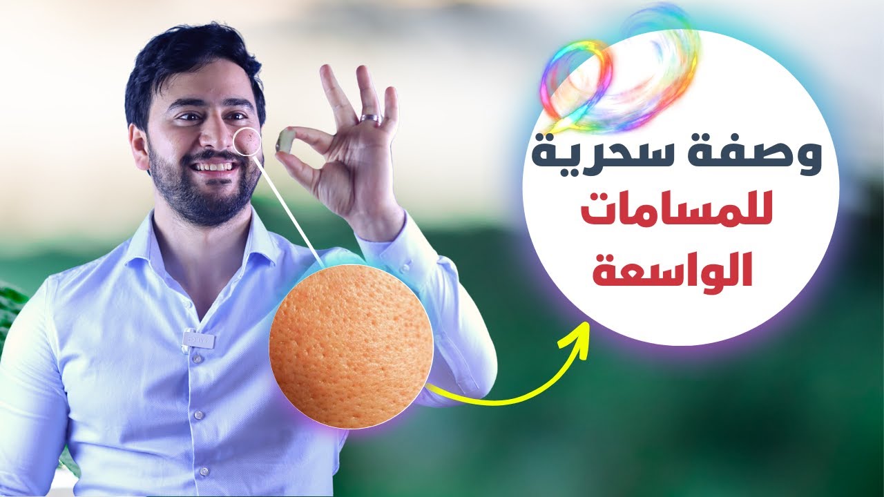 طريقة سهلة لعلاج المسامات الواسعة والبشرة الدهنية 🏅