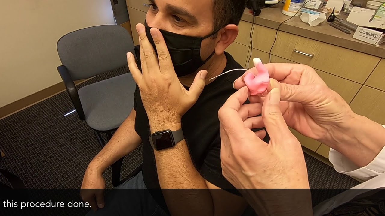 Custom In Ear Monitors with Sensaphonics and Ultimate Ears